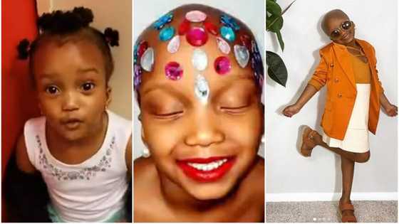 Bald, bold and beautiful: Girl who lost all her hair turns things around, becomes an Instagram sensation