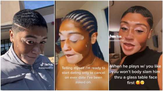 "Stop hiding your face": Lady with rare skin colour looks shy in video, many say she's beautiful