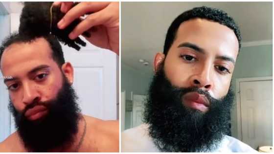 Man shows how he fixed receding hairline using women's weave-on, sparks reactions online