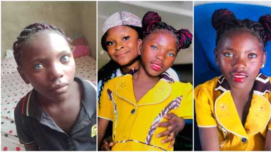 Hotunan Yarinyar Da Aka Haifa Da Idanu Masu Launin Shudi Sun Ja Hankali