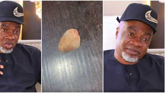 God gave me another chance: Olaiya Igwe shares near-death experience, photo of stone removed from his kidney