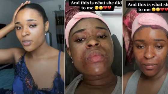 Duniya Ba Yarda: Bidiyon Yadda 'Yar Aiki Ta Bata Fuskar Yar Gida, Ta Mata Mummunan Illa