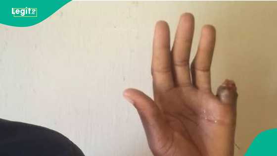 Mutumin da ya guntule yatsar shi kan Naira miliyan 80 ya yi biyu babu a Kano