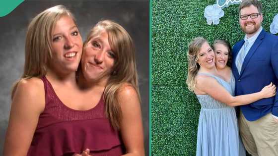 Abby and Brittany Hensel: Conjoined twins break silence after news of Abby's marriage went viral