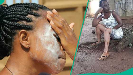 Najeriya ta zama hedikwatar masu 'bleaching', Minista ya fadi Illoli, ya gargadi mata