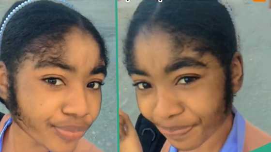 "You are unique": Fair-skinned lady with plenty hair on her face goes viral as people admire her