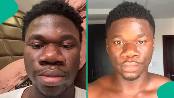Nigerian man spends N18 million on nose job, flaunts his new look in video
