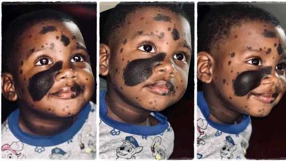 "He looks very unique": Handsome boy with black marks on his face trends online as cute photos emerge