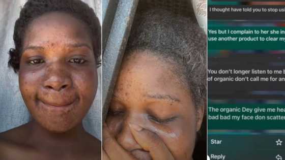 "I no longer like your face": Man breaks up with girlfriend who used organic cream to spoil her skin, chats leak