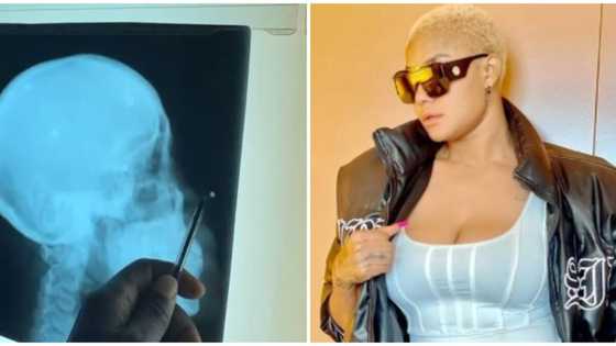 Angela Okorie says pellets still coming out of her head two years after failed assassination