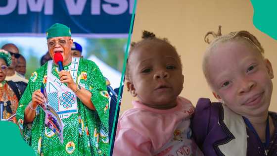 How I was mocked for my albinism during campaigns, Akwa-Ibom gov narrates ordeal