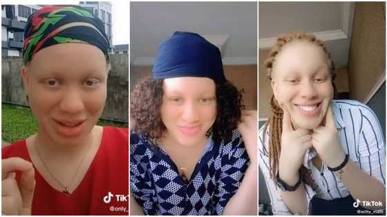 "I was not allowed to go out": Albino lady with perfect skin reveals how she became beautiful