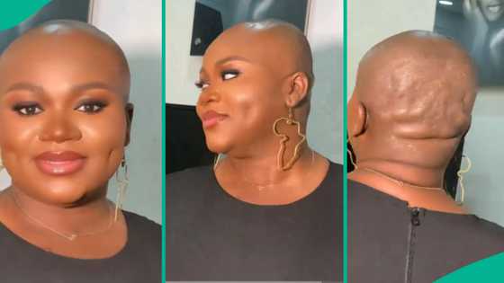 Techie breaks the internet with her bald look, Nigerians react