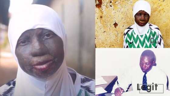 Bana iya numfashi: Ku taimakawa Rokibat a magance wata bakuwar cuta dake cin fuskarta