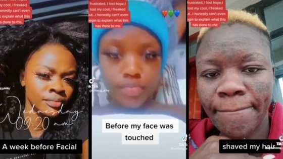 Wurin neman kiba: Bidiyon yadda aka lalatawa budurwa fuska daga zuwa gyaran fata