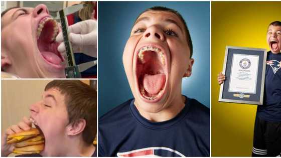Teen shatters Guinness record for having the widest mouth that takes an apple, can and baseball at once