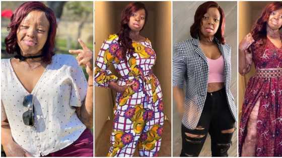 10 times plane crash survivor Kechi Okwuchi gave body positivity goals in nice photos