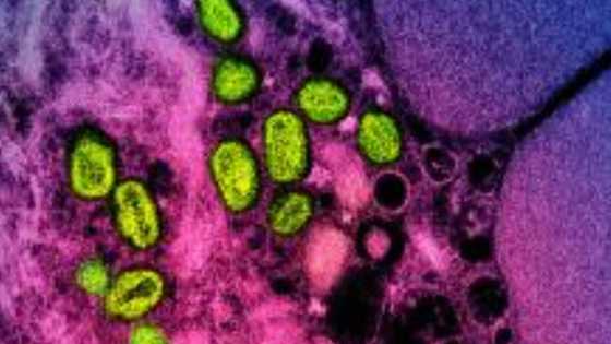 Monkeypox to be renamed mpox: WHO