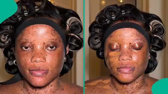 Lady shows amazing makeup transformation as artist covers her freckles: "She is beautiful"