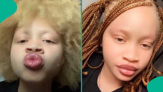 UTME 2026: Albino lady who sat for exam goes viral as her result surfaces online