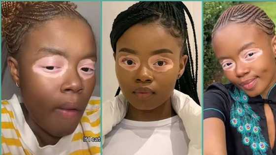 "It's not bleaching": Lady with shiny circle around her eyes flaunts unique beauty, video trends