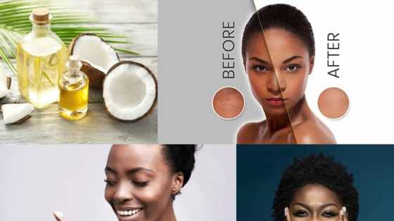 Coconut oil for skin whitening: does it work and how to use it