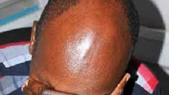 Ya ga samu ya ga rashi: Wata budurwa ta fasa auren Saurayinta ana gobe ɗaurin aure bayan ta ga sanƙo a kansa