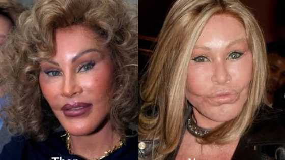 15 most outrageous celebrities' plastic surgery fails
