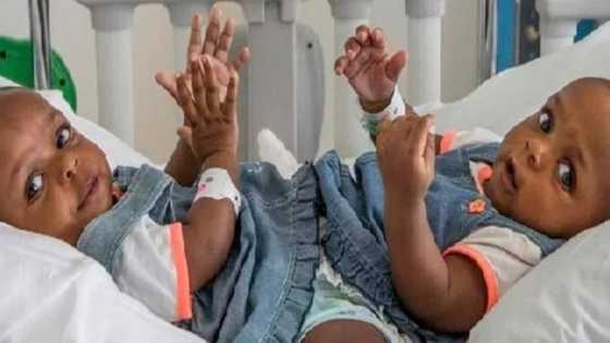 Wasu zakakuran likitoci a jihar Adamawa sun raba wasu jarirai 2 da suka zo Duniya a hade