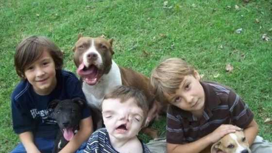 Abin Al-ajabi: Wani yaro mai fuskoki 2 yayi tsawon rai har shekaru 13 (Hotuna)