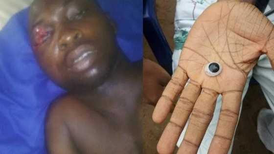 Please save this policeman who survived the Zenith Bank robbery in Imo state (photos)